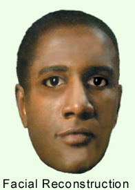 Facial Reconstruction