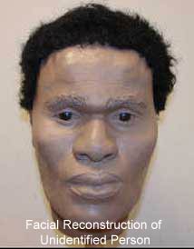 Facial Reconstruction of Unidentified Person