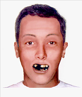 Computerized Facial Reconstruction of Unidentified Person