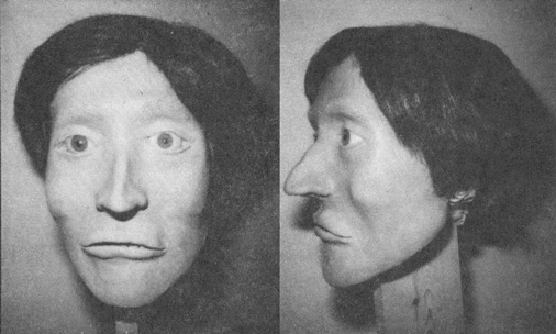 Facial Reconstruction of Unidentified Homicide Victim